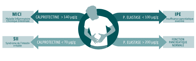 Image of Solution complète pour l'identification des troubles gastro-intestinaux : Tests rapides et lecteur dédié